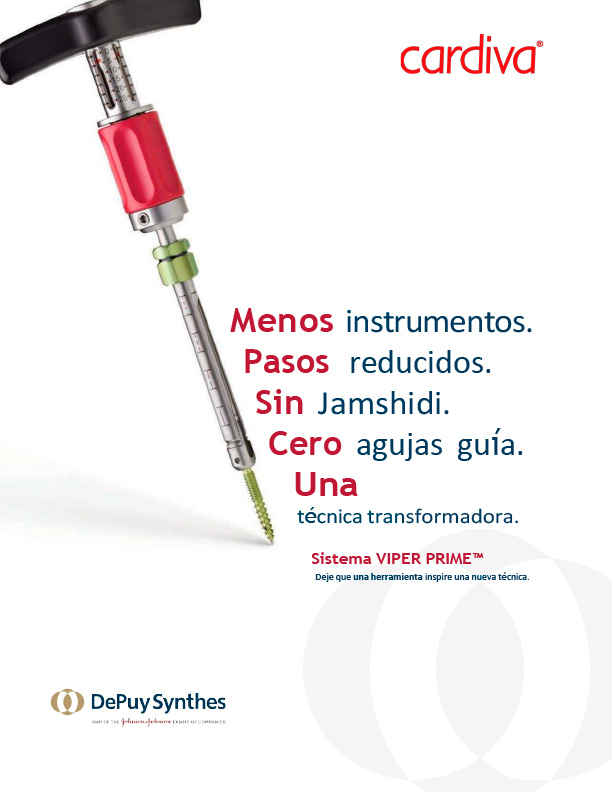 SISTEMA VIPER PRIME<sup>&TRADE;</sup>