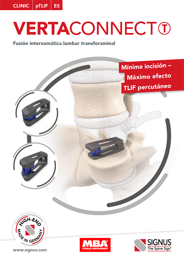 VERTACONNECT