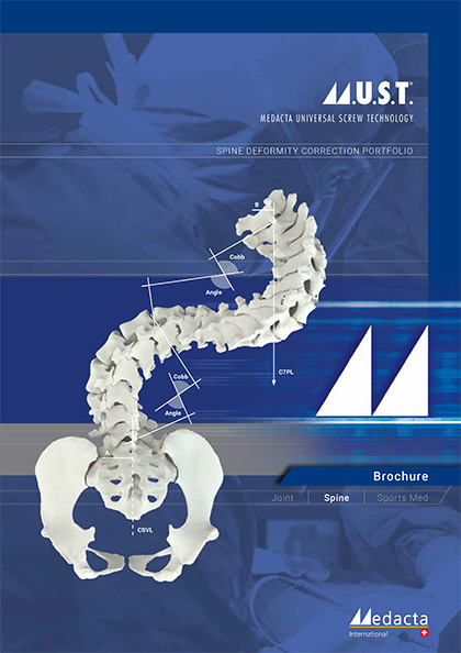 M.U.S.T.<sup>&reg;</sup> DEFORMITY