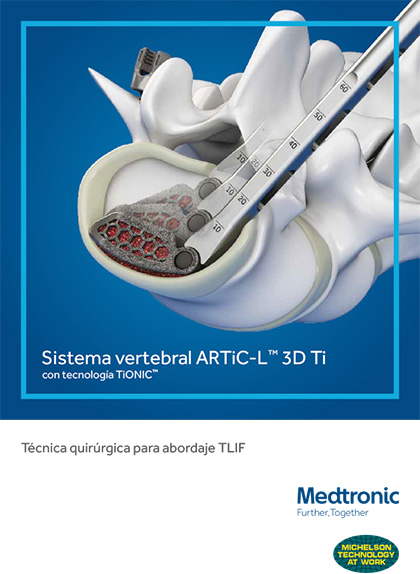 ARTIC-L<sup>&trade;</sup> 3D Ti
